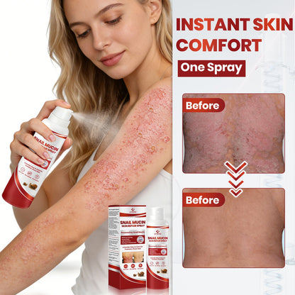 Lyyeto® Snail Mucin Skin Repair Spray