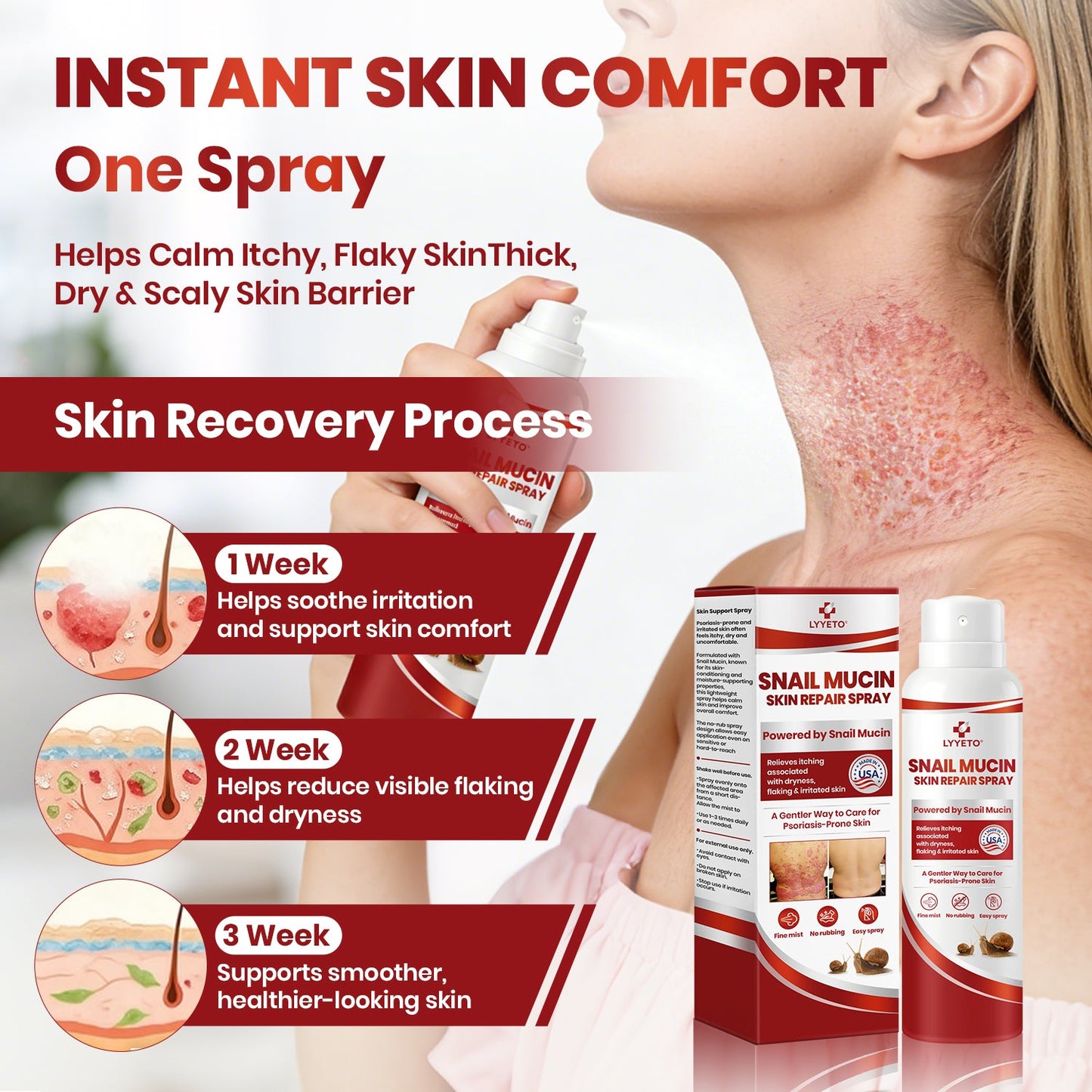 Lyyeto® Snail Mucin Skin Repair Spray