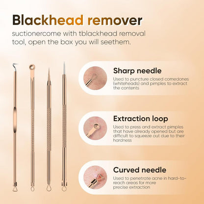Rechargeable Pore Vacuum - 6-in-1 blackhead remover with smart display and extraction kit M1
