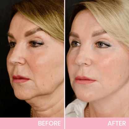 LUHAKA® V-Face Lifting Invisible Adhesive Tape 🪄M3
