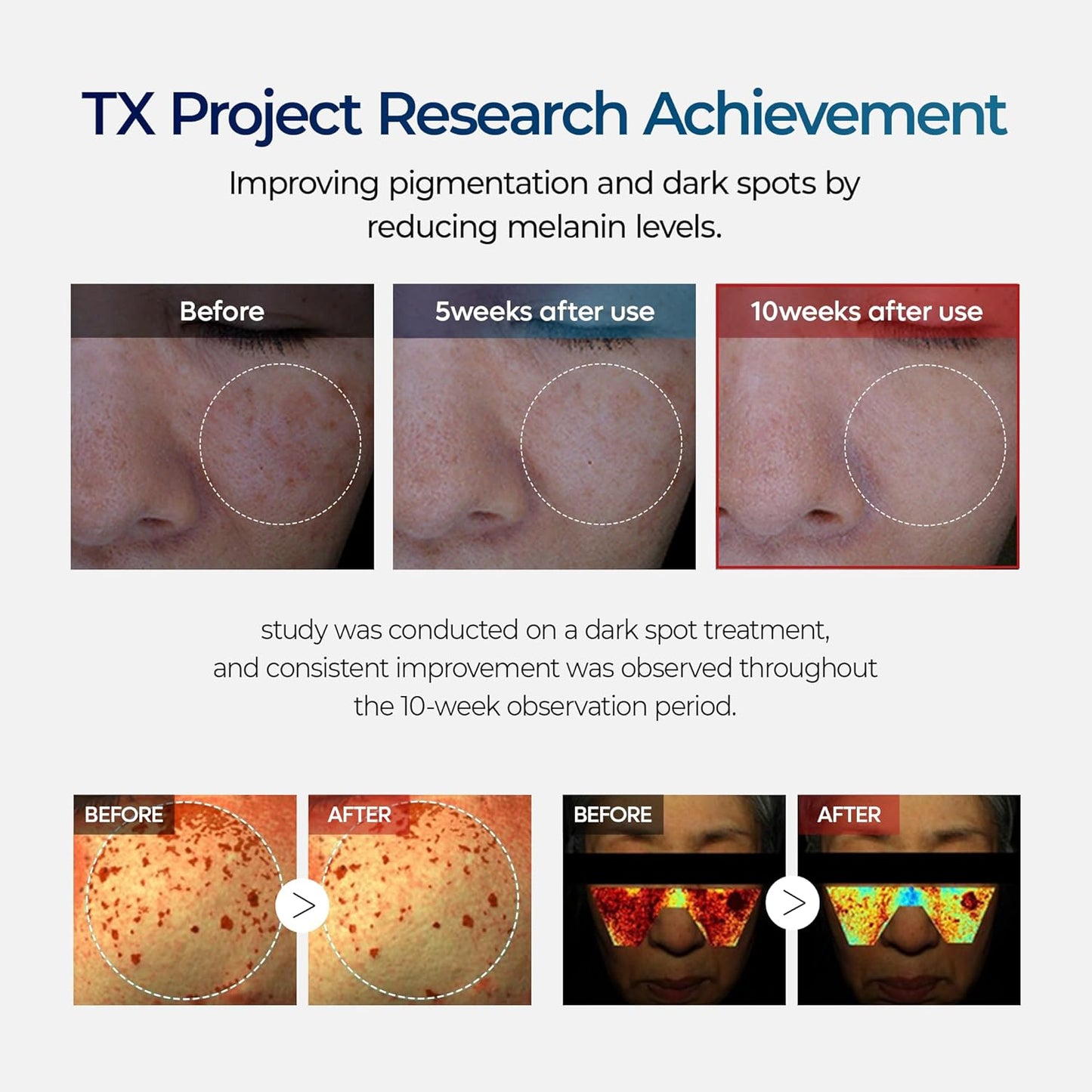 Luhaka®🧪TX Cream Nano-sized Tranexaminc Acid for Dark Spots & Hyperpigmentation