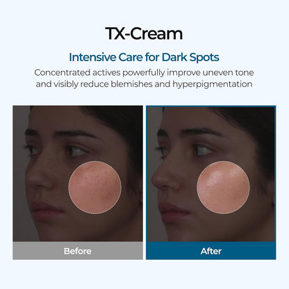Luhaka®🧪TX Cream Nano-sized Tranexaminc Acid for Dark Spots & Hyperpigmentation
