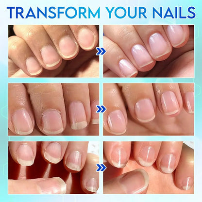 Cilifer®💅✨Universal Automatic Fingernail Grinder for Adults and Children👶