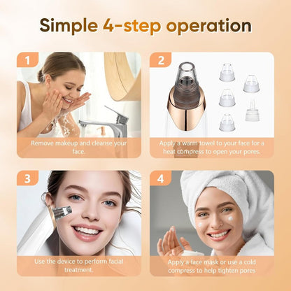 Rechargeable Pore Vacuum - 6-in-1 blackhead remover with smart display and extraction kit M1